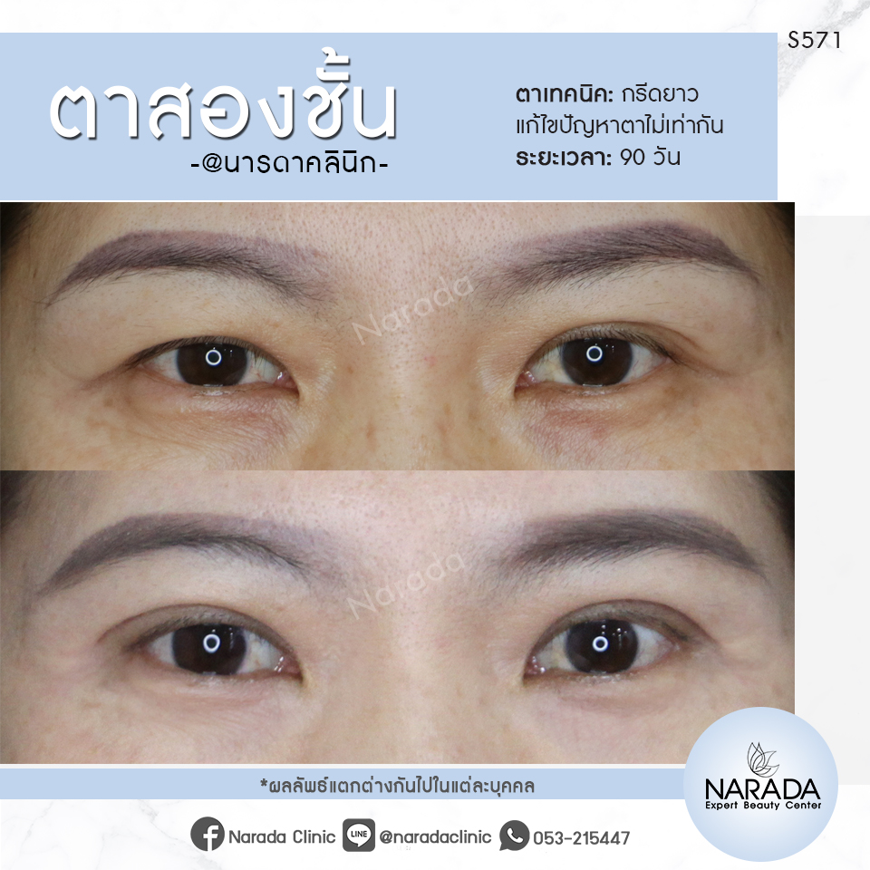 My Image 21