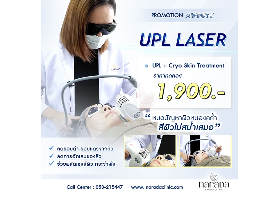 UPL Laser