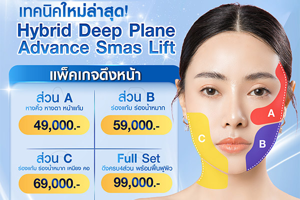 ดึงหน้า